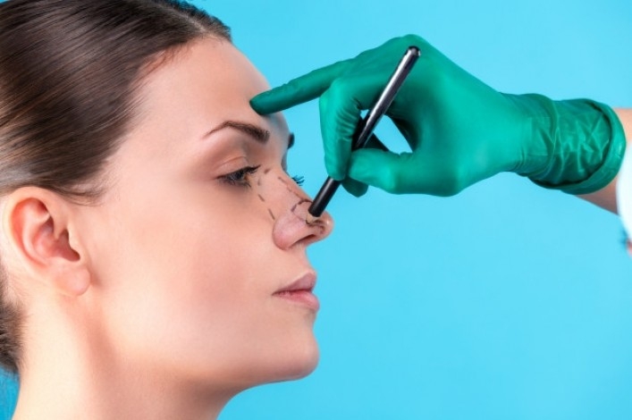 Rinoplasti ile İlgili Sıkça Sorulan Sorular